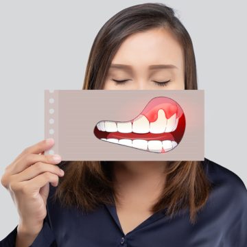 Can I Save My Teeth If I Have Periodontal Disease?